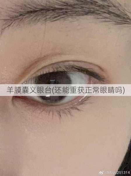 羊膜囊义眼台(还能重获正常眼睛吗)