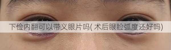 下俭内翻可以带义眼片吗( 术后眼睑弧度还好吗)