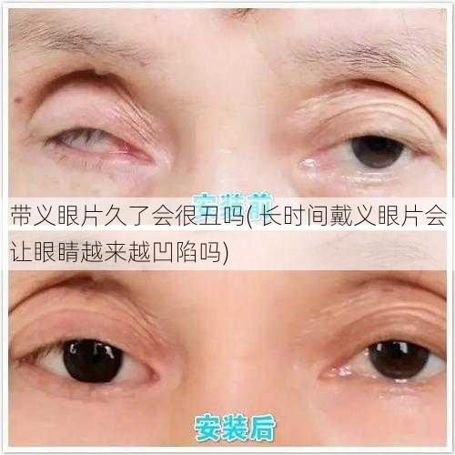 带义眼片久了会很丑吗( 长时间戴义眼片会让眼睛越来越凹陷吗)