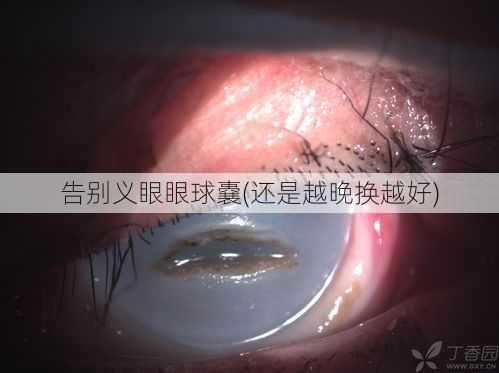 告别义眼眼球嚢(还是越晚换越好)
