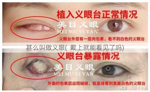 甚么叫做义眼(  戴上就能看见了吗)