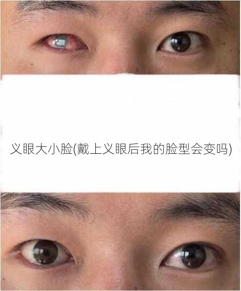 义眼大小脸(戴上义眼后我的脸型会变吗)