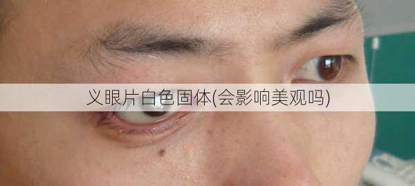 义眼片白色固体(会影响美观吗)