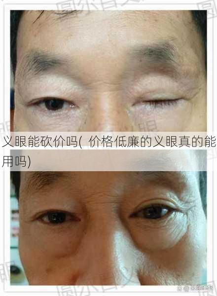 义眼能砍价吗(  价格低廉的义眼真的能用吗)