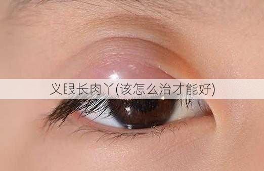 义眼长肉丫(该怎么治才能好)