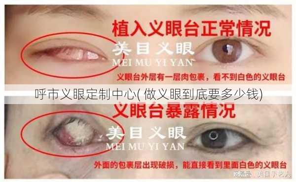 呼市义眼定制中心( 做义眼到底要多少钱)