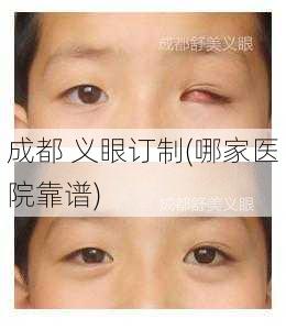 成都 义眼订制(哪家医院靠谱)