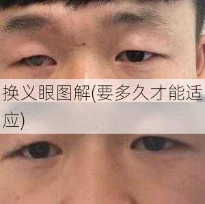 换义眼图解(要多久才能适应)