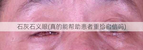 石灰石义眼(真的能帮助患者重拾自信吗)