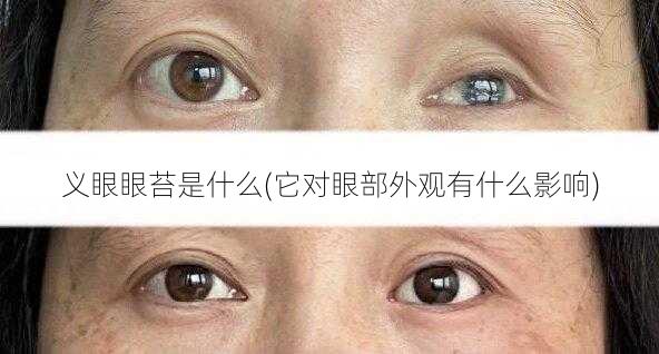 义眼眼苔是什么(它对眼部外观有什么影响)
