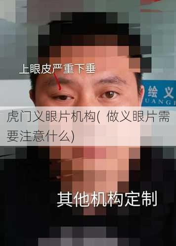 虎门义眼片机构(  做义眼片需要注意什么)