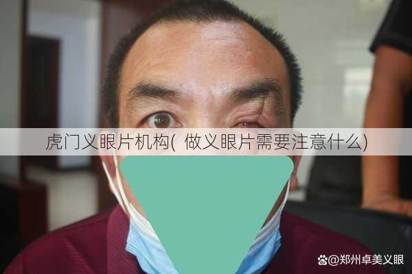 虎门义眼片机构(  做义眼片需要注意什么)