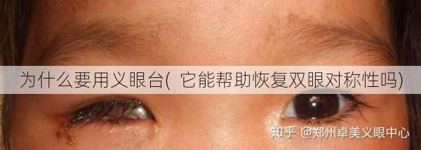 为什么要用义眼台(  它能帮助恢复双眼对称性吗)