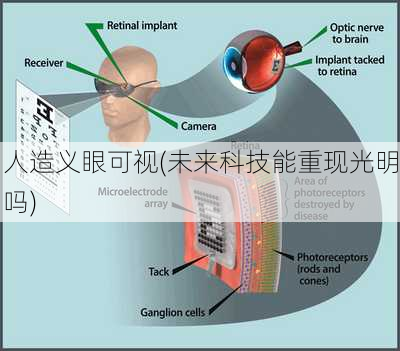 人造义眼可视(未来科技能重现光明吗)