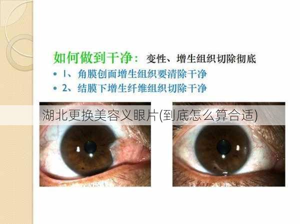 湖北更换美容义眼片(到底怎么算合适)