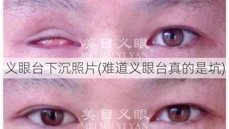 义眼台下沉照片(难道义眼台真的是坑)