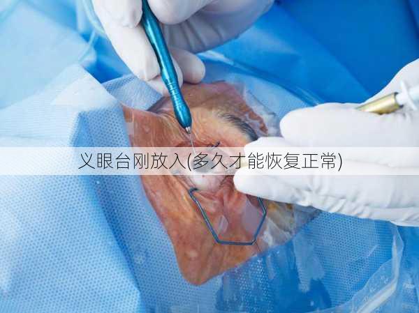 义眼台刚放入(多久才能恢复正常)