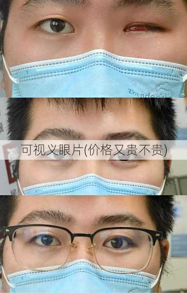 可视义眼片(价格又贵不贵)