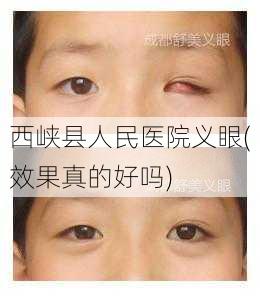 西峡县人民医院义眼(效果真的好吗)