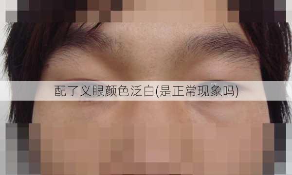 配了义眼颜色泛白(是正常现象吗)