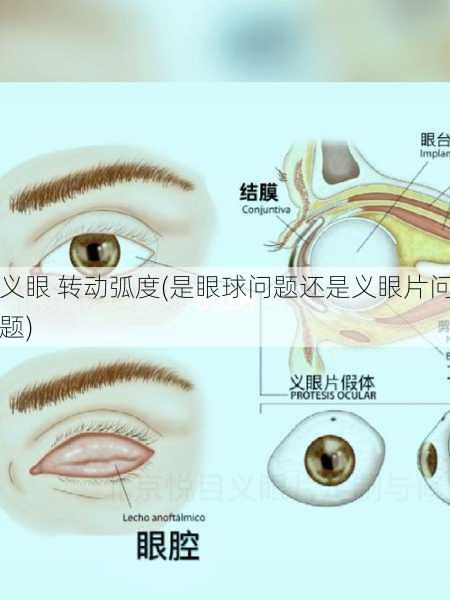 义眼 转动弧度(是眼球问题还是义眼片问题)