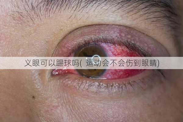 义眼可以踢球吗(  运动会不会伤到眼睛)