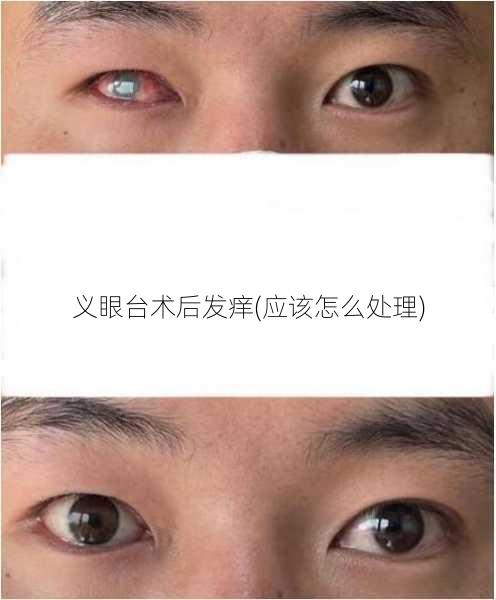 义眼台术后发痒(应该怎么处理)