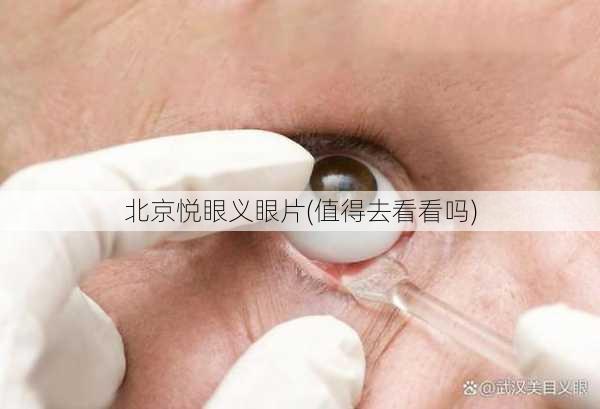 北京悦眼义眼片(值得去看看吗)
