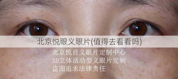 北京悦眼义眼片(值得去看看吗)