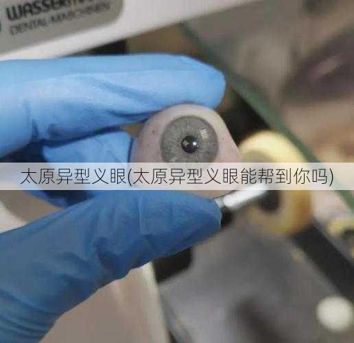 太原异型义眼(太原异型义眼能帮到你吗)