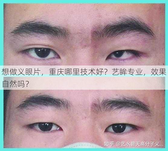 想做义眼片，重庆哪里技术好？艺眸专业，效果自然吗？