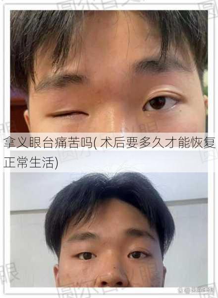 拿义眼台痛苦吗( 术后要多久才能恢复正常生活)