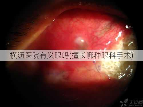 横沥医院有义眼吗(擅长哪种眼科手术)