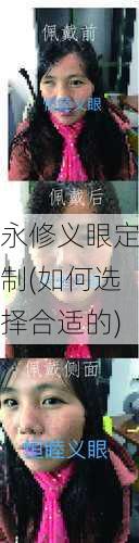 永修义眼定制(如何选择合适的)