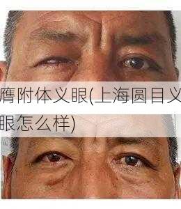 膺附体义眼(上海圆目义眼怎么样)