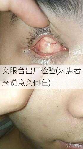 义眼台出厂检验(对患者来说意义何在)