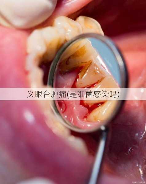 义眼台肿痛(是细菌感染吗)