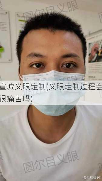 宣城义眼定制(义眼定制过程会很痛苦吗)