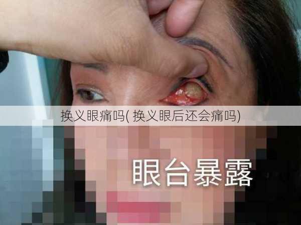 换义眼痛吗( 换义眼后还会痛吗)