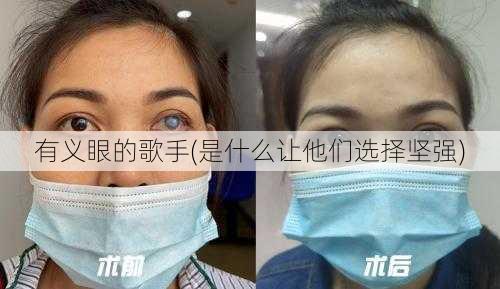 有义眼的歌手(是什么让他们选择坚强)