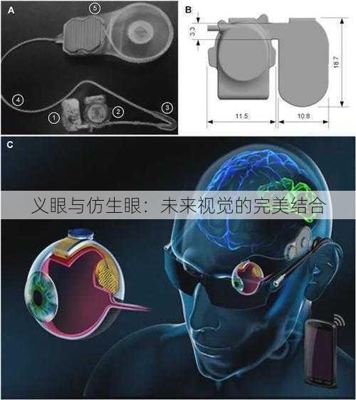 义眼与仿生眼：未来视觉的完美结合