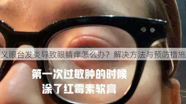 义眼台发炎导致眼睛痒怎么办？解决方法与预防措施