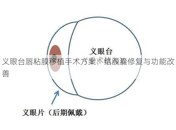 义眼台唇粘膜移植手术方案：结膜囊修复与功能改善