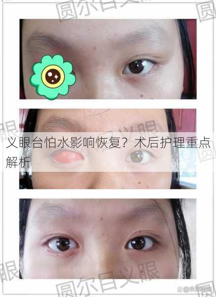 义眼台怕水影响恢复？术后护理重点解析