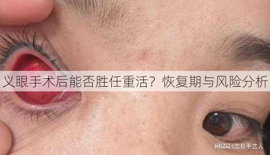 义眼手术后能否胜任重活？恢复期与风险分析