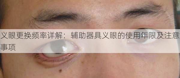 义眼更换频率详解：辅助器具义眼的使用年限及注意事项