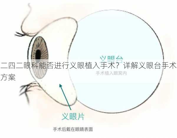 二四二眼科能否进行义眼植入手术？详解义眼台手术方案