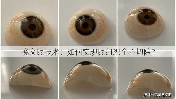 挽义眼技术：如何实现眼组织全不切除？