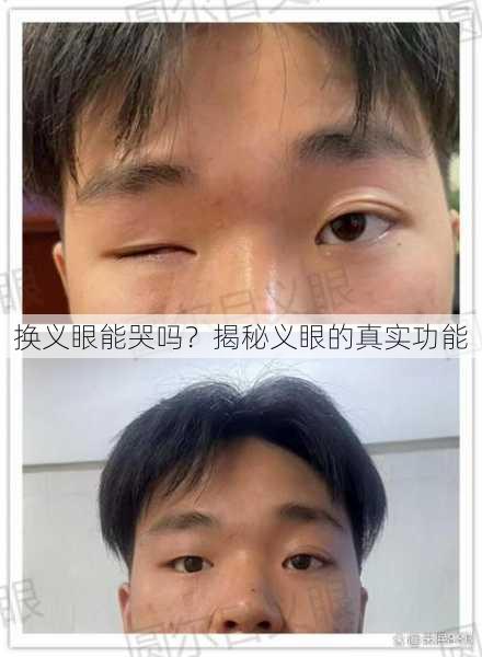 换义眼能哭吗？揭秘义眼的真实功能