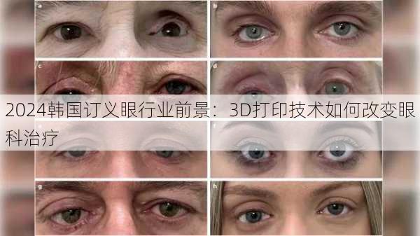 2024韩国订义眼行业前景：3D打印技术如何改变眼科治疗